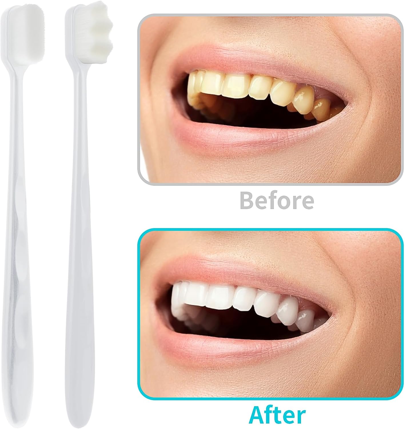 (Buy One Get One Free) Gums Toothbrush With Extra Soft Floss (random Color)